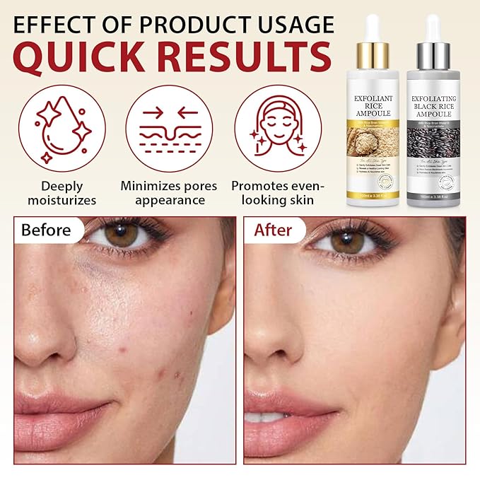 Rice Exfoliating Ampoule Set, Peel Shot Glow Rice Ampoule Duo,Duo for Gentle Peel + Pore Minimizing & Deep Hydration,Body Black and White Rice Exfoliating for All Skin Types 6.76 fl.oz