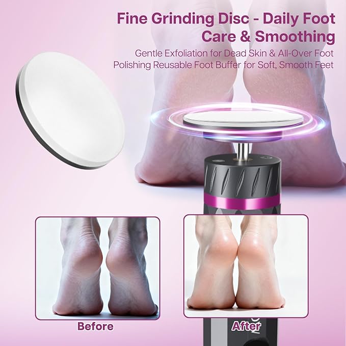 Professional Electric Foot Callus Remover, 9-Speed Cordless Foot File with Reusable Nano Glass Heads & Sandpaper for Dead Skin Removal and Smooth Feet