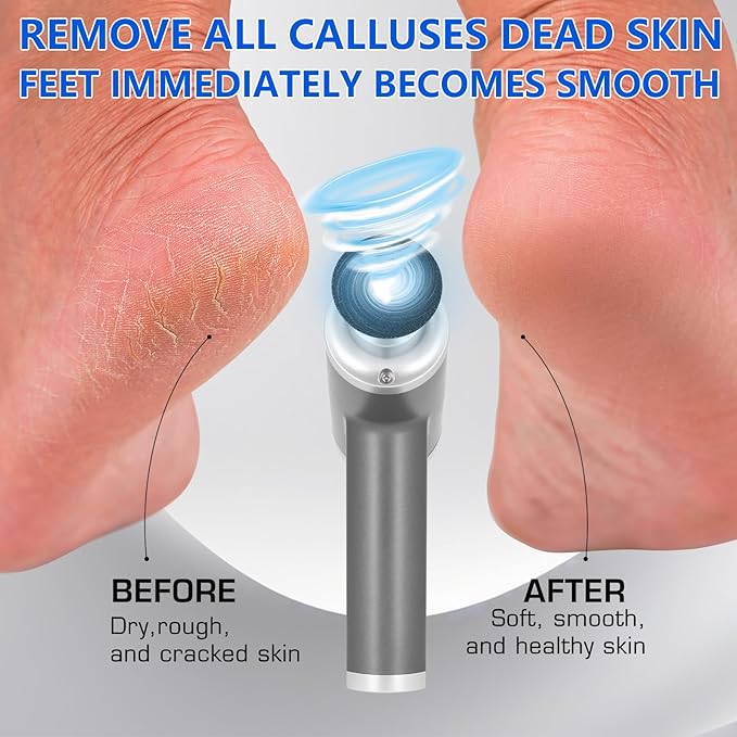 Upgraded Electric Callus Remover for Feet 4500rpm, Professional Electric Foot Callus Remover Foot Sander Pedicure File with 2 Interchangeable Heads and Replaceable Sandpaper Discs