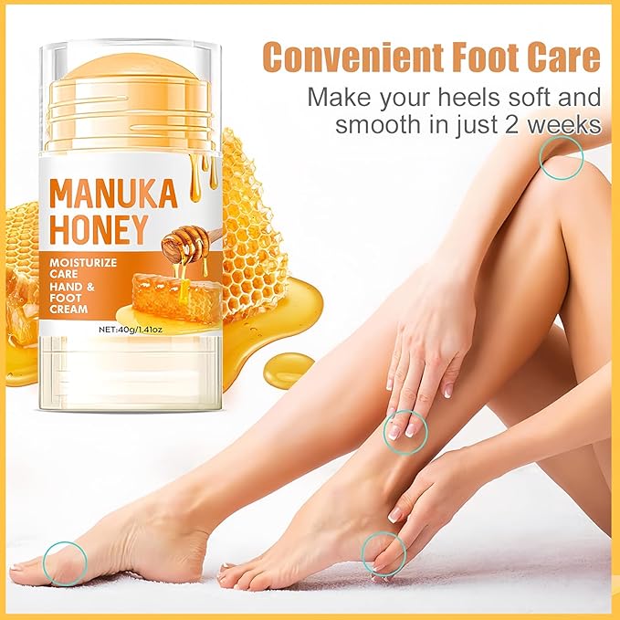 2Pcs Manuka Honey Foot Balm Stick, Moisturizing Hand and Foot Cream for Dry Cracked Heels, Heel Stick Balm for Women & Men, Callus Hydrating Cream for Hands, Elbows & Knees
