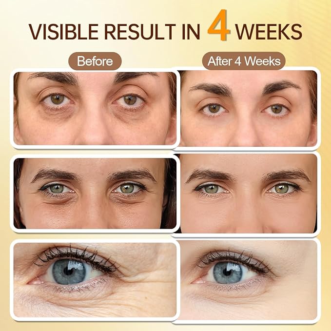 Under Eye Brightener Serum Roller - Retinal & Caffeine Eye Cream for Puffy Eyes, Dark Circles, Wrinkles, Puffiness, with 360° Cooling Depuffing Ball, Travel Toiletries Essentials (15ml/0.51fl oz)