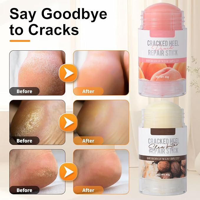 Shea Butter Dry Cracked Hands and Feet Repair Stick, Moisturizing Foot Cream with Shea Butter and Coconut Oil，Moisturizes and Softens Heels, Gently Exfoliates and Improves Dry Skin，1.41 OZ