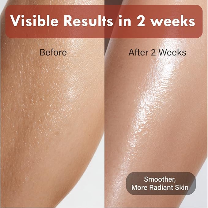 Korean Red Bean Body Lotion - 24-Hour Hydrating Moisturizer for Dry Skin with Peptides & Hyaluronic Acid for Smooth Sensitive Skin Women & Men - Vegan & Cruelty-Free - 8.45 fl oz