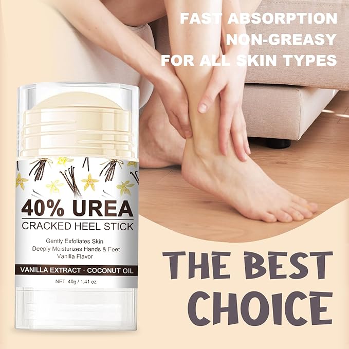 Urea Cream 40 Percent for Dry, Cracked Heels and Feet with Coconut Oil & Vanilla Planifolia, Callus Remover and Skin Softener, Maximum Strength Foot & Hand Cream – 1.41 oz