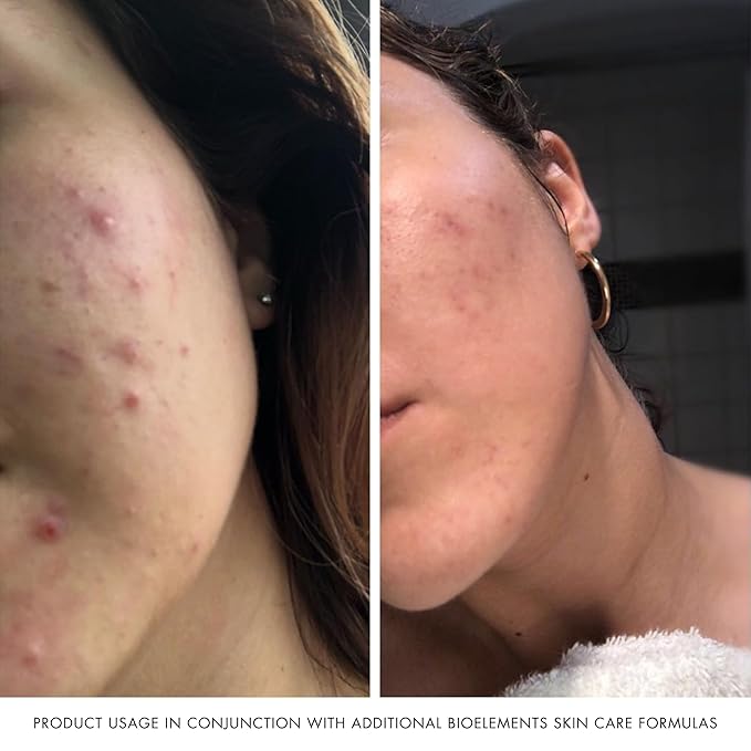 Bioelements Crucial Moisture - 2.5 fl oz - Emollient Cream Facial Moisturizer for Dry Skin - Improve Fine Lines - Vegan, Gluten Free - Never Tested on Animals