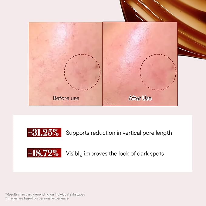 VT COSMETICS Red Booster Reedle Shot 100 Serum with Dragon’s Blood Extract & Exosome Microneedling Formula, Korean Skincare, 1.69 fl oz(50ml)