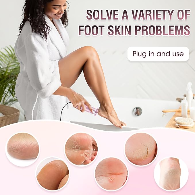 Electric Foot File Callus Remover: Adjustable Speed 1000RPM Feet File Grinder with 60 Pcs Sandpaper Discs - Professional Pedicure Tools for Dead Skin Calluses (Pink)