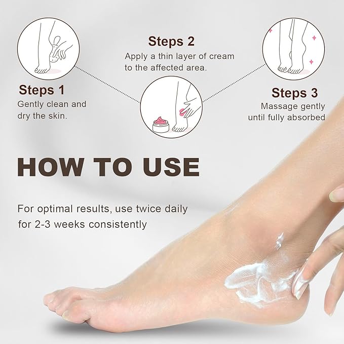 60% Urea Foot & Hand Cream with 2% Salicylic Acid - Intensive Moisturizer for Dry, Cracked Heels, Feet, Elbows, Hands and Knees - Foot Exfoliating Creams with Jojoba Oil, Avocado Oil & Aloe Vera, 7 oz