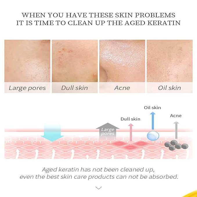 LAIKOU Camomile Peeling Gel, 60g – Gentle Exfoliating Face Gel for Dead Skin Removal, Deep Cleansing, Brightening & Pore Minimizing, Suitable for All Skin Types