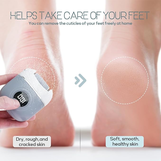 Electric Foot Callus Remover, Rechargeable & Waterproof Pedicure Tool with 3 Roller Heads, 2 Speeds for Dead, Hard, Cracked, Dry Skin Care