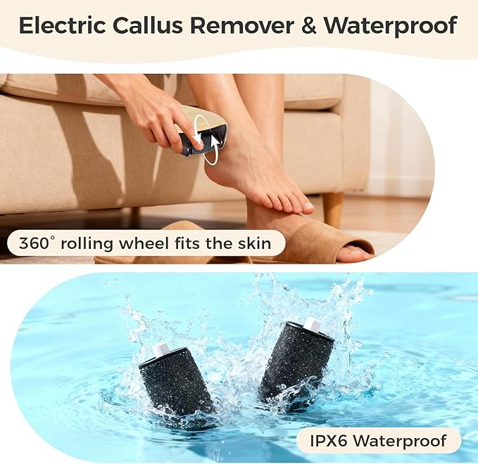 Foot Callus Remover｜Patented 3D Roller + 2-Speed 丨LED｜30,000 RPM High-Frequency Exfoliation｜Portable for Home & Travel｜Stylish Foot Care for Men & Women (Pink)