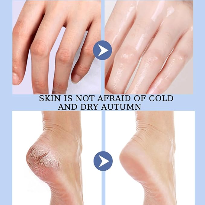 Vovo Angel Winter Foot Care Cream with Aloe Vera & Urea – Deep Moisturizing Heel Repair Balm for Dry, Cracked Feet, Softening & Nourishing Foot Moisturizer, 40g (Aloe Vera, 40g)