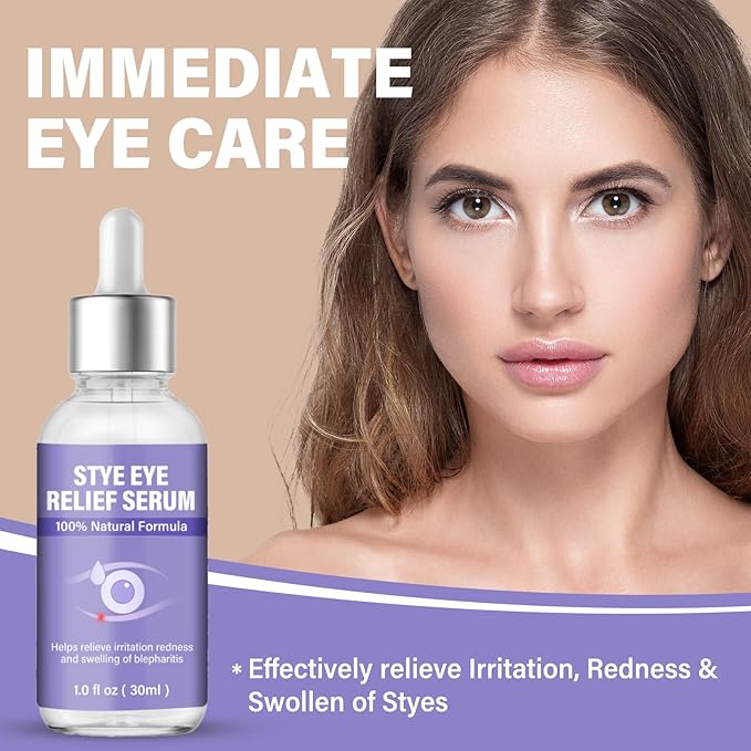 Stye Eye Treatment, Eye Reflief Serum for Styes and Chalazions, Natural & Non-Irritating, Fast-Acting Soothing and Restores Healthier Skin, 30ml