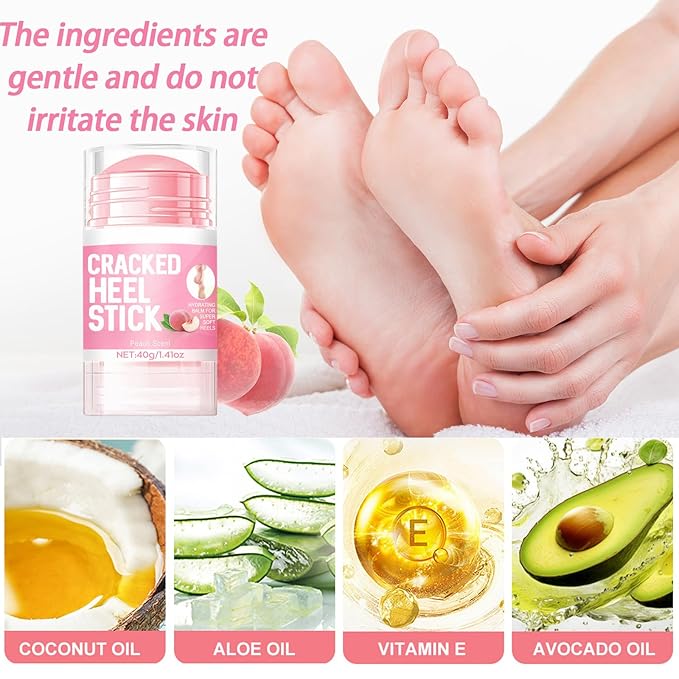 60% Hydrating Urea Foot Cream,Cracked Heel Stick Plus 2% Moisturising Salicylic Acid, Foot Balm Stick for Removing and Smoothing Cracked Hands Elbows Feet Knees, Peach Scent Heel Balm Repairs Dry Skin