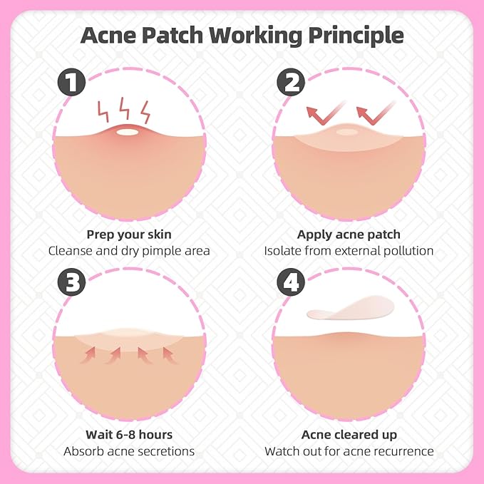 EFLY Pimple Patches for Face, Acne Patches Hydrocolloid with Tea Tree Oil, Salicylic Acid & Calendula Oil, 2 Sizes Invisible for Makeup Zit Patches Dots (324)
