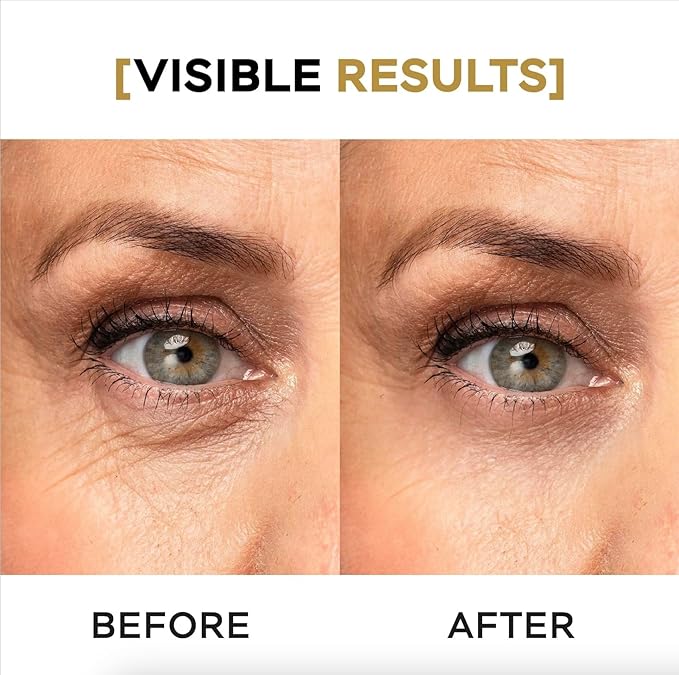 VITASEI Moisturizing Eye Cream w/Aloe Vera, Collagen, Hyaluronic Acid, Cotton Stem Cells for Dark Circles, Puffiness & Bags - Under Eye Hydration Cream for Women & Men (1 Fl Oz)