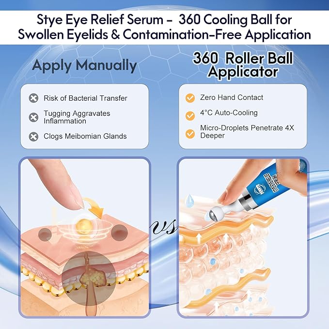 Stye Eye Treatment, Multi-Effect Eye Serum, Chalazion Soothing Care Drops with 360° Massage Rollerball - Moisture & Botanical Extract Formula, Cruelty-Free (1 Fl Oz (Pack of 1))