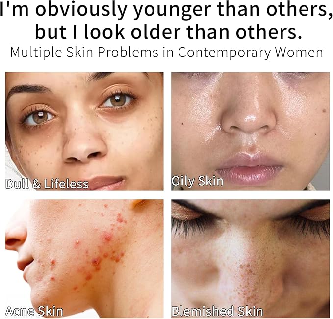 Rose Water Face Toner, Moisturizing & Anti-Aging for All Skin Types (13.5Fl Oz)