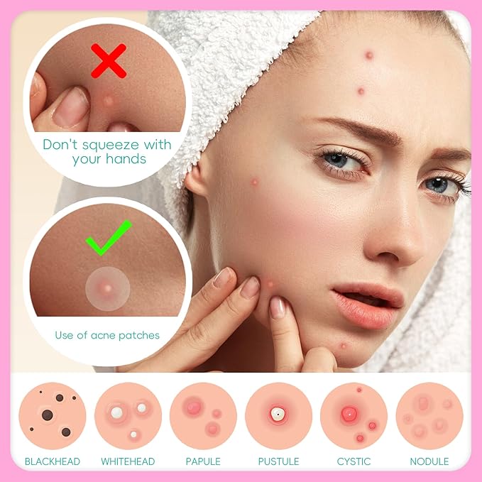 EFLY Pimple Patches for Face, Acne Patches Hydrocolloid with Tea Tree Oil, Salicylic Acid & Calendula Oil, 2 Sizes Invisible for Makeup Zit Patches Dots (324)