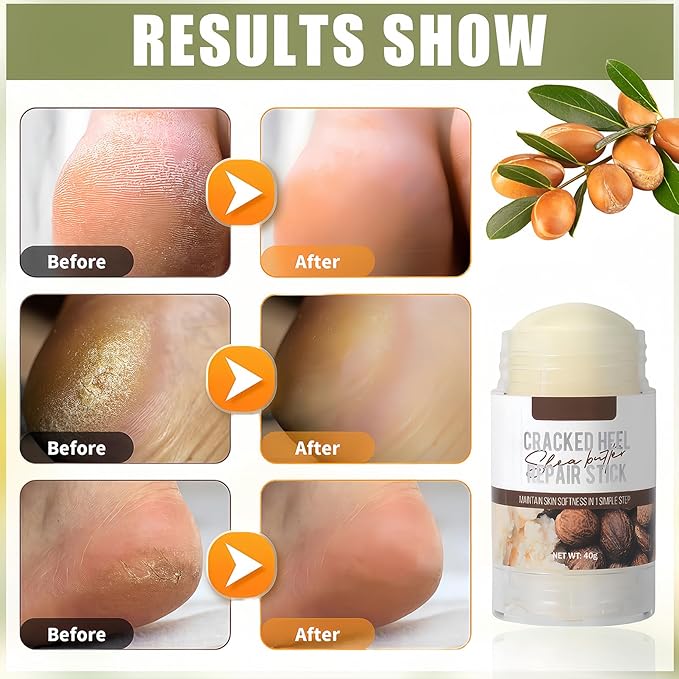 Shea Butter Hydrating Foot Cream, Coconut Nail Softening Hand and Foot Cream Balm Stick, Gentle Soften Heel Balm That Improve Dry Skin for Men Daily Skin Care, 1.41 Oz 1Pc