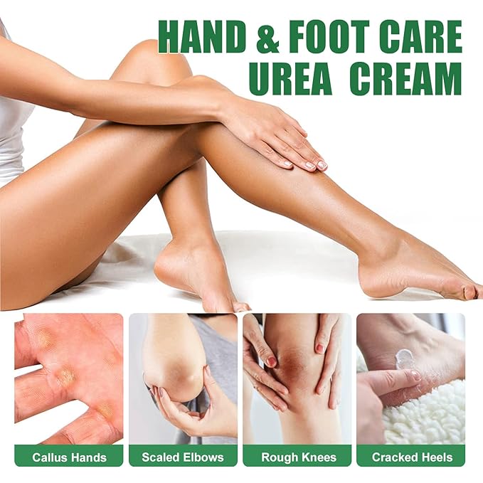 Urea Cream 60% plus 2% Salicylic Acid for Feet – Maximum Strength Foot Cream For Dry, Cracked Heels and Calluses. Deeply Exfoliates Dead skin & Moisturizes, Repairs Rough Feet – 6.35 oz