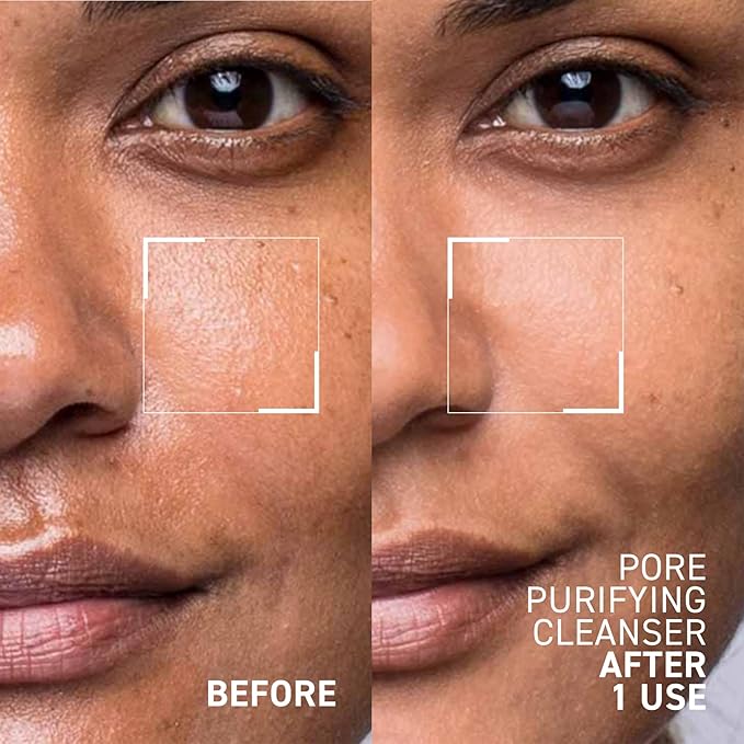 Dr. Brandt Skincare Pore Purifying Cleanser, 3.5 Fl Oz