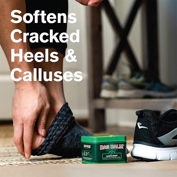 Bag Balm Vermont's Original for Dry Chapped Skin Conditions 8 Ounce Tin