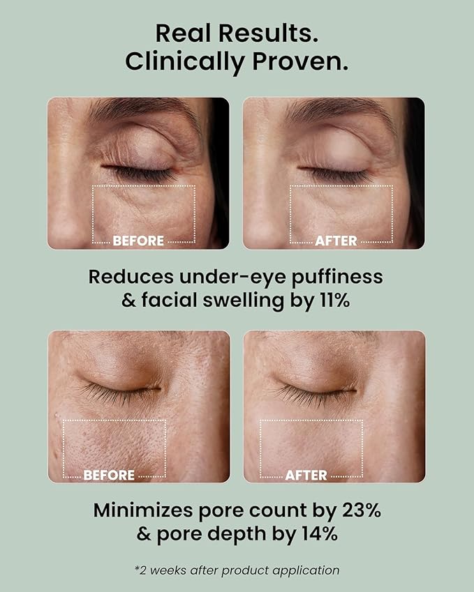 Ice Roll Serum for Face, Puffy Eyes, Under Eye Bags - Panthenol & Tannin for Hydrating, Pore Minimizing, Ice Roller for Puffiness, Redness, Dark Circles - Korean Skin Care & Gua Sha, 1.69 Fl Oz