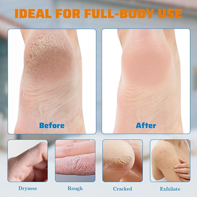 Urea Cream 60 percent for Feet Maximum Strength with 2% Salicylic Acid for Dry Cracked, Soothes and Softens Foot Hands Elbows Knees Heels, Remove Calluses Deep Moistrizing with Aloe Vera, 8.8 oz