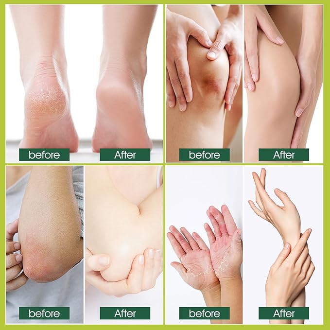 Daily Foot Moisturizer Cream, Feet Cream for Dry Cracked Heels Knees Elbows Hands, with Salicylic Acid & Macadamia Ternifolia Seed Oil & Shea Butter, Deeply Moisturize and Remove Calluses, 1.763 Fl.Oz