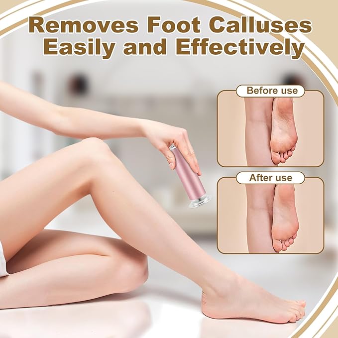 Feet Heel Shaver for Men Women, Electric Callus Grinder for Foot Filer Remover Pedicure Tools, Professional Sander Callus Remover with 60Pcs Sandpaper Discs Dead Cracked Skin and Calluses (Pink US)