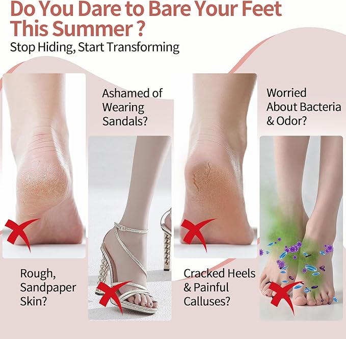 Electric Foot Callus Remover, Rechargeable Electric Callus Remover for Feet with 3 Speed, 9 in 1 Pedicure Kit with Nano-Glass, Waterproof Professional Foot File for Dead, Hard, Cracked Skin(Yellow)