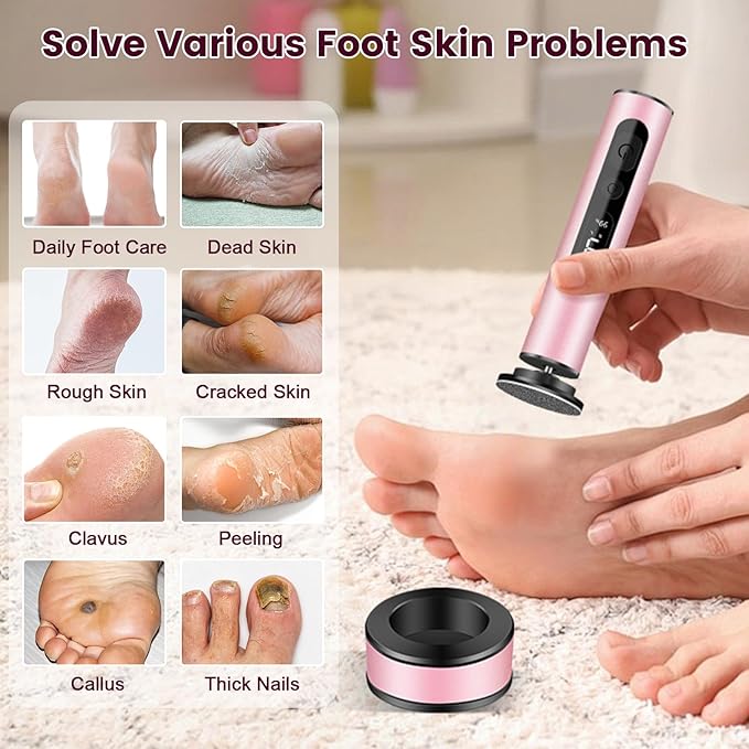 Electric Foot Callus Remover with LED Battery Level & 9-Speed Control Display. Callus Remover for Feet with Wireless Charger, Multi-sandpape (70 Sheets) & Nano Glass Head for Dead Skin (Pink)