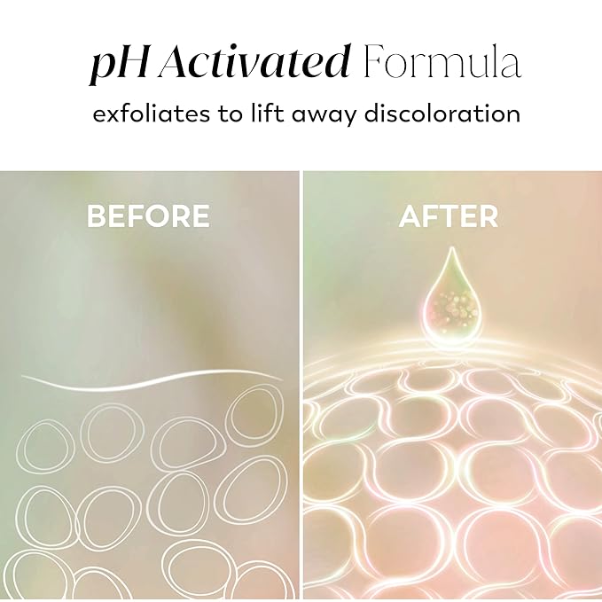 Olay Body Lotion for Women, Tone Enhancing with AHA Serum, Visibly Reduce Discolored Skin, 24hr Moisture & Hydration, Fast Absorbing Formula, Vitamin B3 Complex, For All Skin Types, 17 fl oz