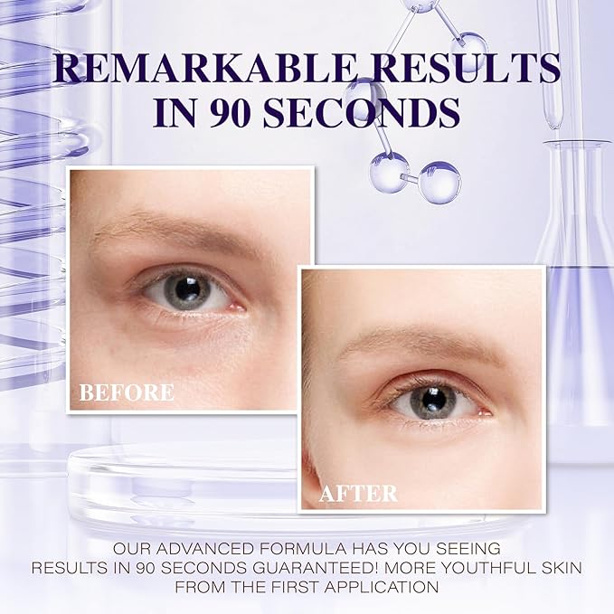 Under Eye Bags and Wrinkles 2.0 - Instant Face Lift Cream,Remove Dark Circles, Bags Under Eyes, Fine Lines, Wrinkles and Neck Lines,Firming Delicate Skin