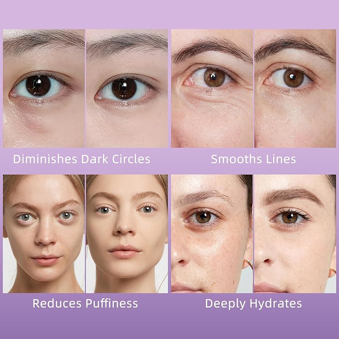 Caffeine Eye Serum for Puffy Dark Circles, Instant Depuffing Under Eye Treatment Anti-Aging Firming Undereye Serum with Roller for Wrinkles Bags Fine Lines Brightening Christmas 0.5 Floz