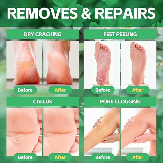 Pedicure Foot Soak, Foot Spa Soak, Pedicure Kit, Bubble Foot Bath for Tired & Dry Cracked Feet, Athletes Feet, Odor Foot and Softens Calluses, Foot Soak 16 Packs A Box, Jasmine