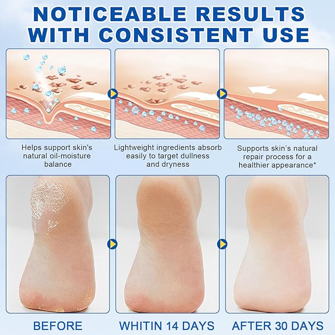 60% Urea Cream Stick with 2% Salicylic Acid, Foot Balm Stick for Dry Cracked Feet, Knees, Elbows, Hands, Callus Remover, Soften Dead Skin, Intensive Hydrating Cracked Heel Balm for Dry Skin