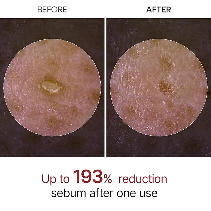 Dr.Melaxin Peel Shot Glow Rice Peeling Ampoule 80ml Daily Soft Exfoliating Face and Body Scrub Dead Skin Cells Blackhead Remover for All Skin Types korean skin care