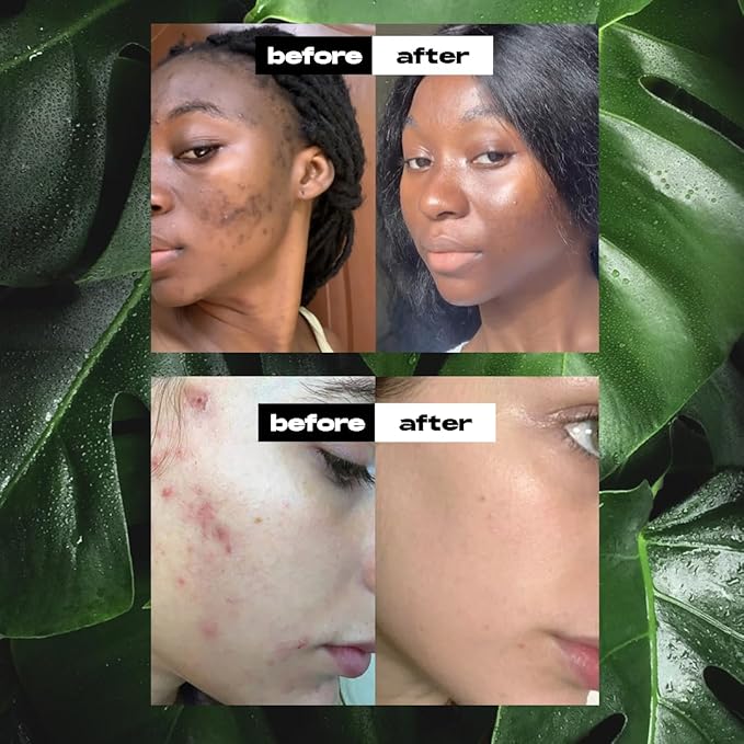 Raw African Black Soap 1lb Bar, for Dry Skin and Skin Conditions, Pure & Natural Ingredients, Imported From Ghana Handcraft Cleanser for Face, Body, and Hair, Vegan & Gentle Skin Care Bar