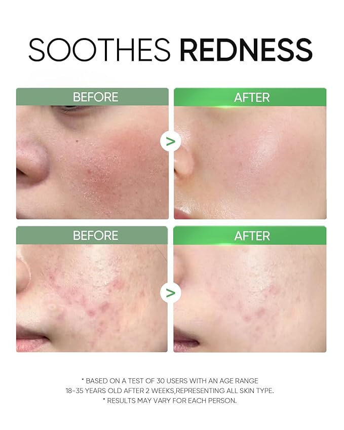 Mugwort Clay Stick Mask for Face, Mud Masks with Centella, Salicylic Acid, Gentle Exfoliation, Vegan Korean Skincare Wash-Off Facial Mask for Sensitive Skin