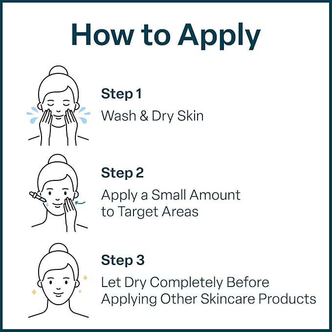 QRxLabs 15% Glycolic Acid Face Serum - Brightening Serum & Dark Spot Corrector - Gentle Face Exfoliator - Anti-Aging Skin Care for Fine Lines & Wrinkles - 1 Fl Oz