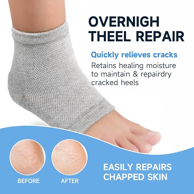 A pair of moisturizing heel socks, combined with a professional heel repair balm stick, deeply treats dry and cracked feet, providing intensive hydration and softening