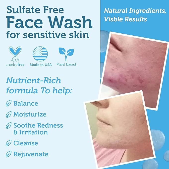 Era Organics Manuka Honey Face Wash for Sensitive Skin - Sulfate Free Gentle Cleanser with Organic Aloe Vera, Hyaluronic Acid & More - Soothing & Moisturizing for Dry Skin - Made in USA (8 oz)