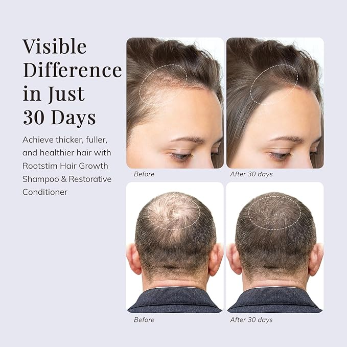 Hair Growth Shampoo and Conditioner Set - Rosemary & Biotin Shampoo and Conditioner for Hair Thickening - Botanical Boost for a Healthy Scalp, Hair Growth and Strengthen