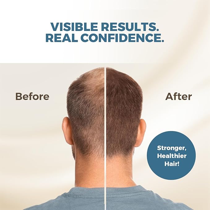 Hairmetto Ecklonia Cava Extract Hair Growth Serum – Styling Gel with Vitamins MSM, Niacinamide & Biotin– Hair Growth Booster for all Hair Types - 4oz (118ml)