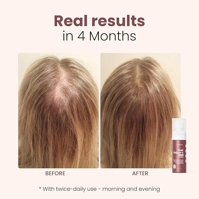 Trybello Hair Helper + Spray | Hair Growth Serum, powered by Capixyl | With Biotin, Castor Oil, Caffeine, Rice Water & Peptide Complex | Natural Treatment for Thicker, Fuller Strands | Vegan Formula