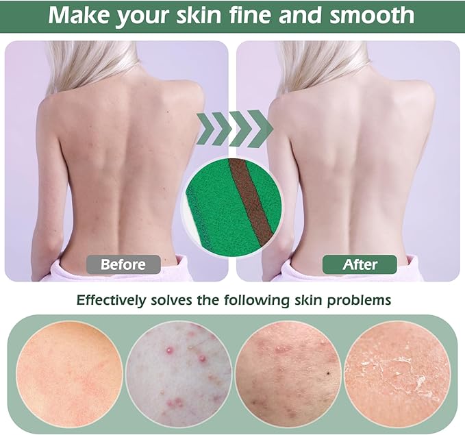 Exfoliating Back Scrubber, Body Back Scrubber Towel for Shower, Bath Wash Scrub Cloth Washcloth Washer for Men Women Exfoliation, Body Scrubbing Brush Exfoliator 500D