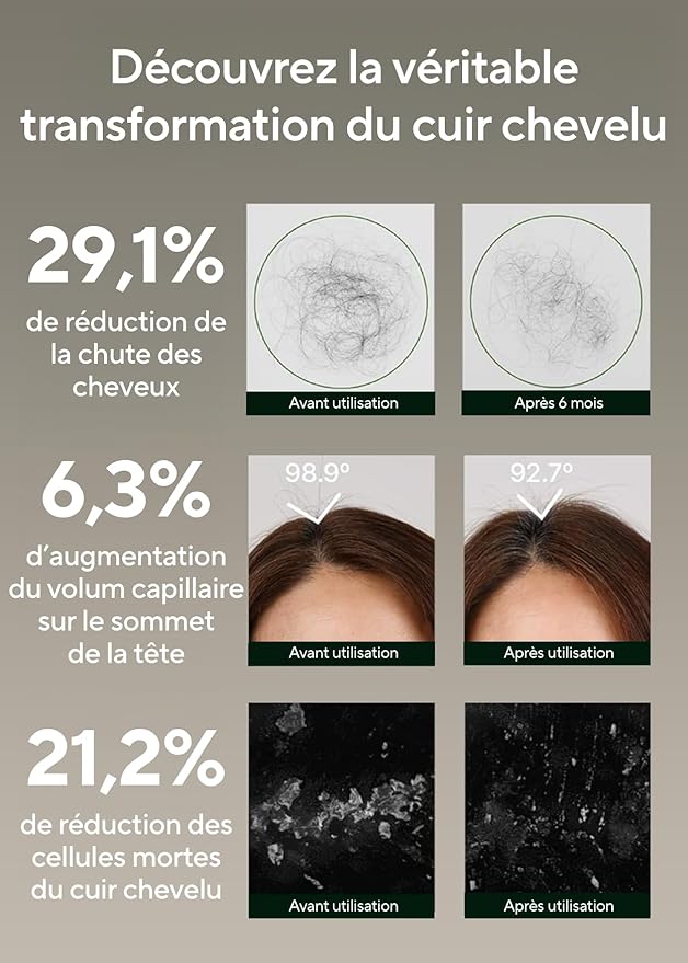 AROMATICA Rosemary Salt Scrub Shampoo - Hair Loss Korean Scalp Detox Shampoo with Rosemary Scalp Oil | Scalp Exfoliator with Salt Scrub for Oily Scalp | Sulfate Free, Silicone Free (10.5 oz / 300g)