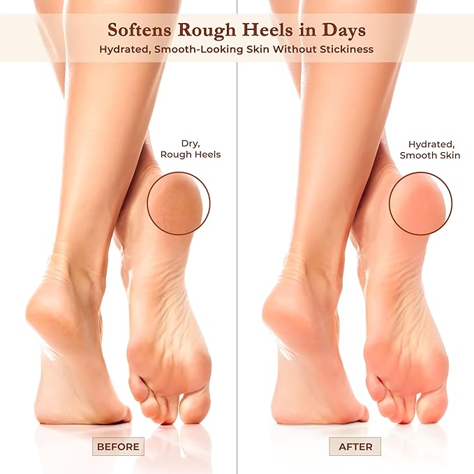 Foot Cream for Dry Cracked Heels and Feet Moisturizer with Argan Oil, Shea Butter & Vitamin E – Hydrating Foot Lotion for Dry Cracked Feet for Women – Smooth, Fast-Absorbing, Non-Sticky Care